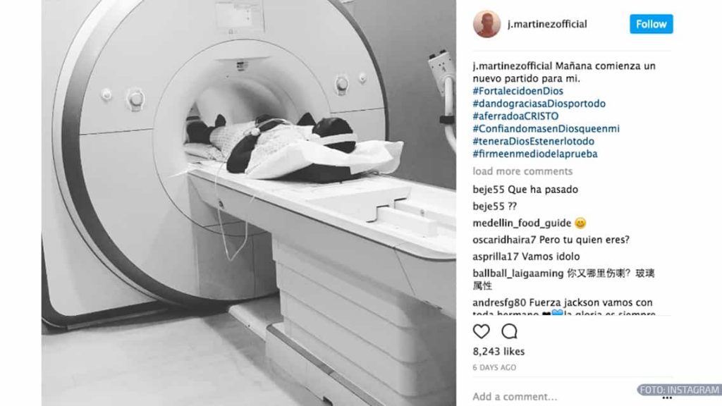 Tremendas imágenes del tobillo de Jackson Martínez tras su operación 1