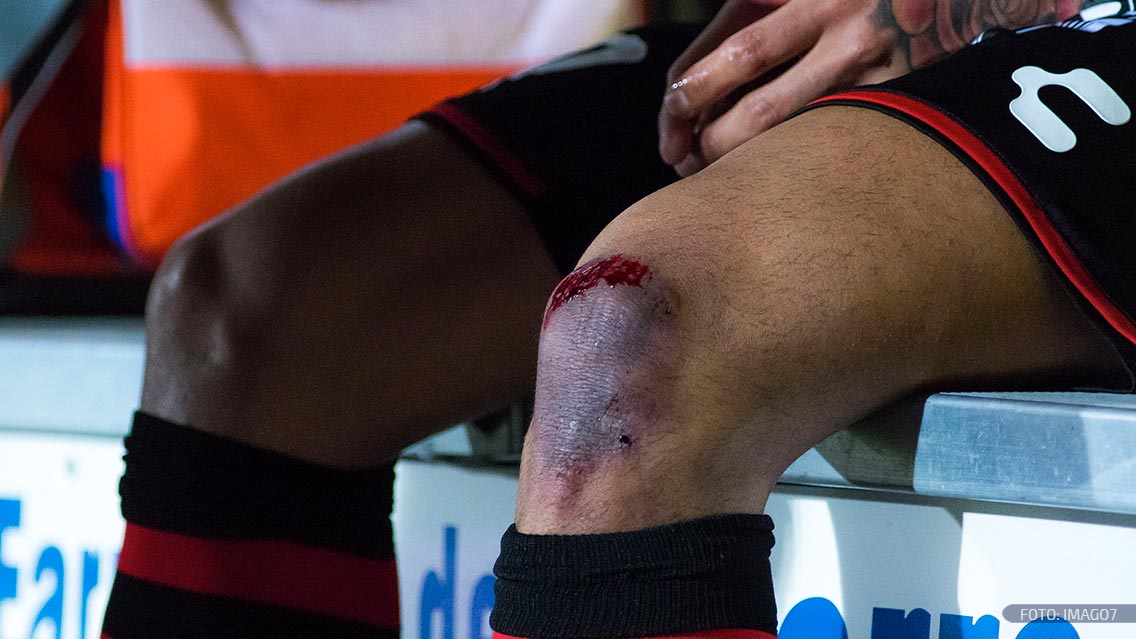 La terrible lesión de Gustavo Bou contra Pumas 0