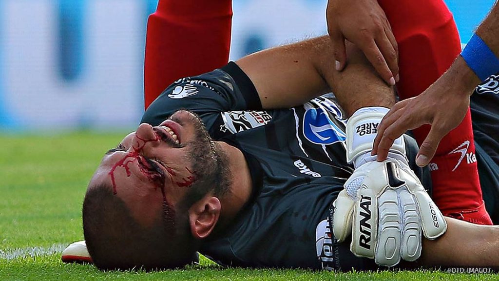 Así quedó Lucero Álvarez luego de su lesión ante Cruz Azul