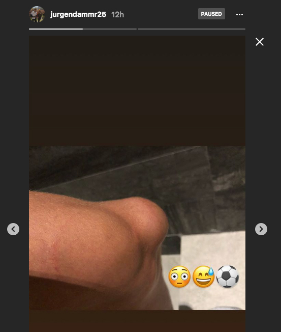 Jürgen Damm sufre tremenda inflamación en su rodilla 0