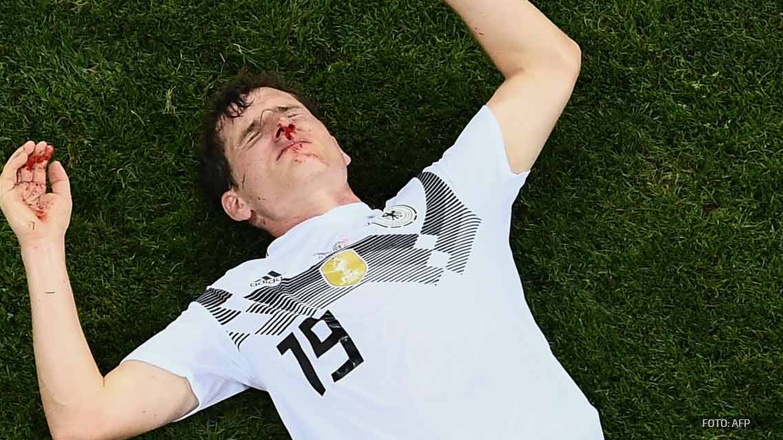 Sebastian Rudy ya fue operado y podría jugar contra Corea