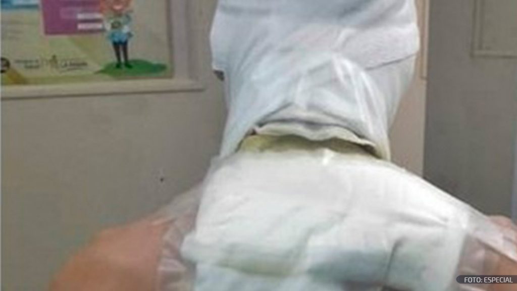 Futbolista sufre quemaduras tras agresión de un aficionado