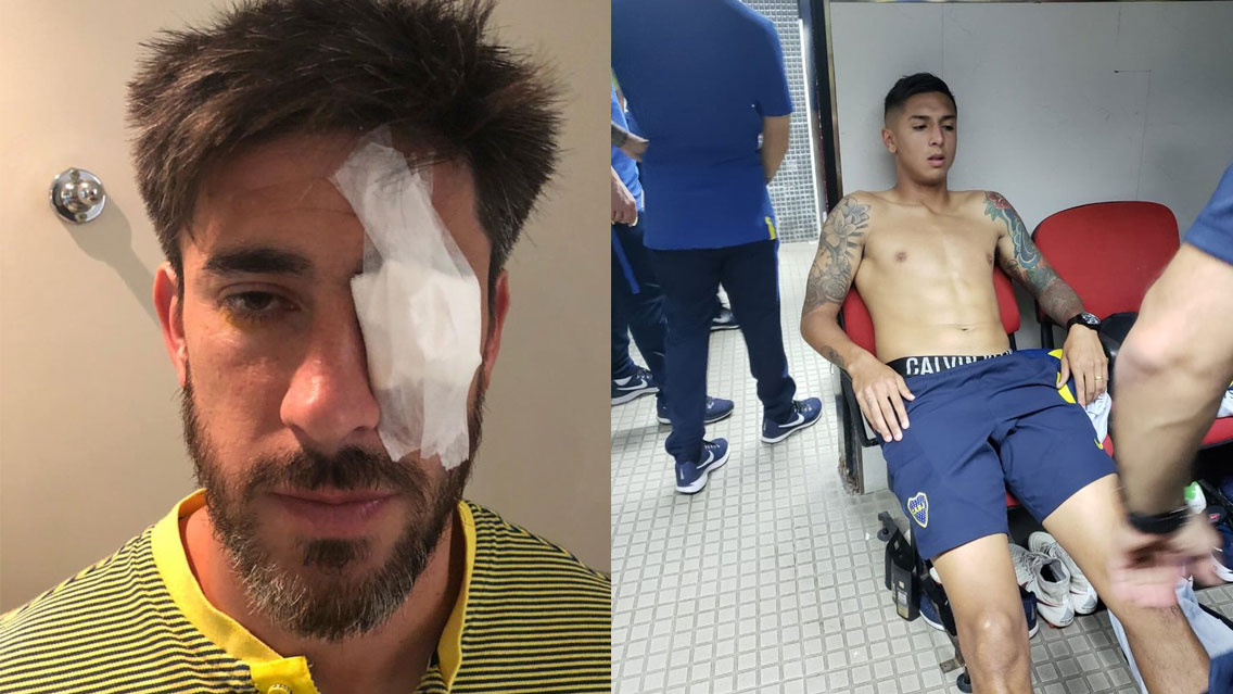 La violencia que se vivió previo al River vs Boca