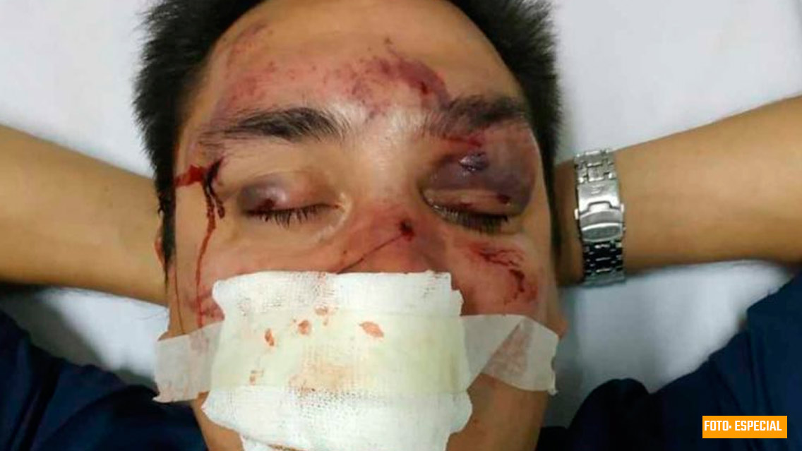Golpean brutalmente a periodista sudamericano