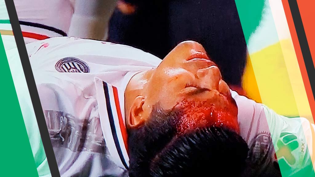 Impresionante herida de ‘Chapo’ Sánchez por patada de Mauro Lainez