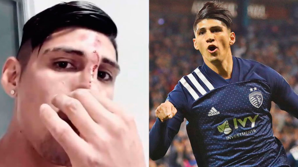 Alan Pulido sufrió doloroso accidente en casa