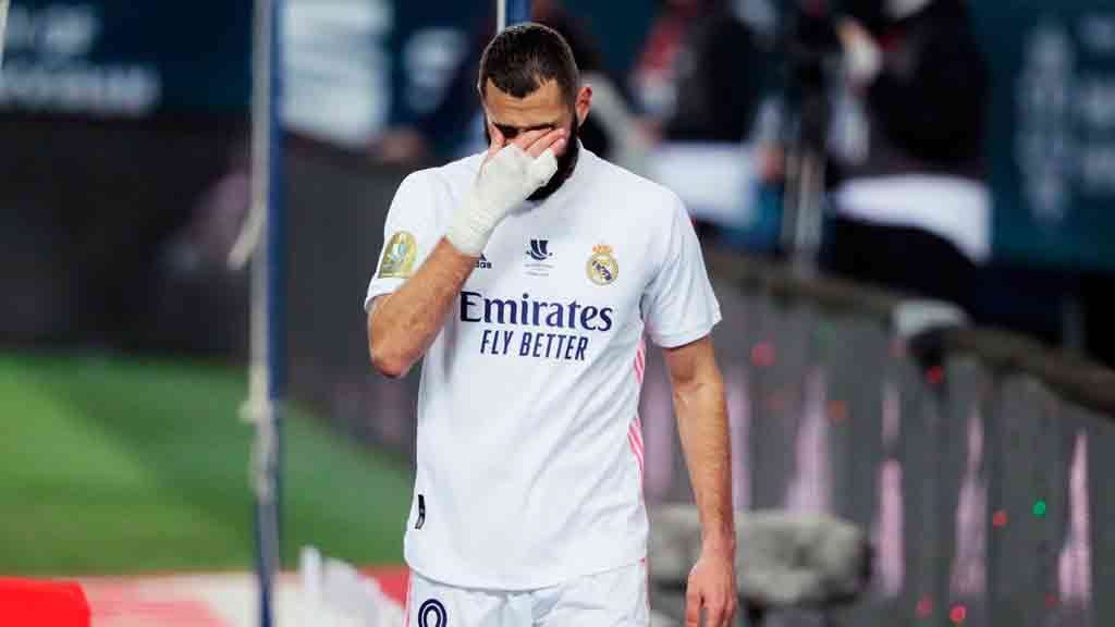 Real Madrid no contará con Karim Benzema en Champions League
