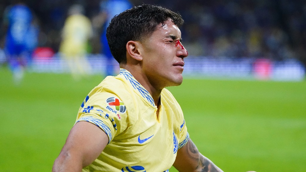 América: Alejandro Zendejas sufrió fractura de nariz, ¿se pierde el torneo?