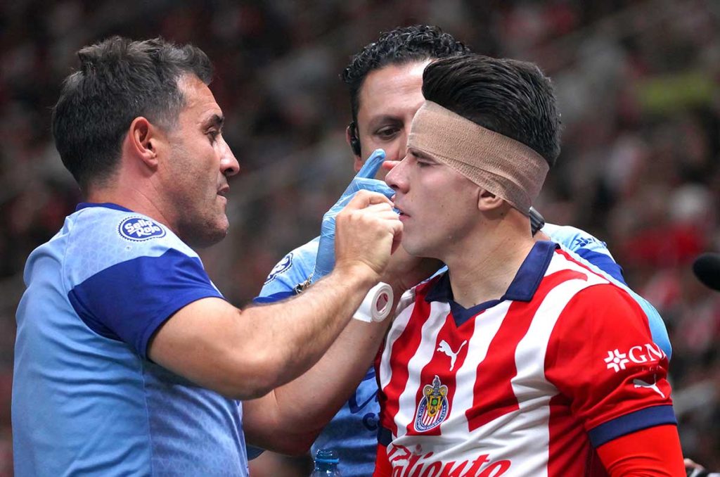 ¿VAR perdonó la roja a Juan Escobar en el Chivas vs Toluca?