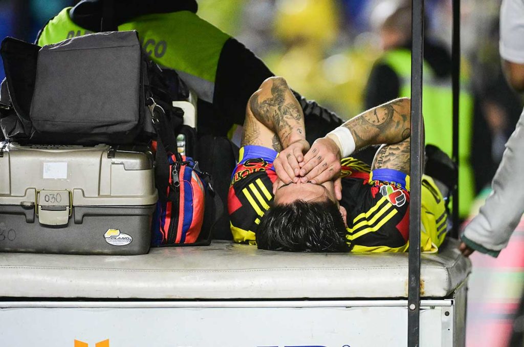 Víctor Dávila estará fuera al menos hasta octubre, pero América no fichara un refuerzo más